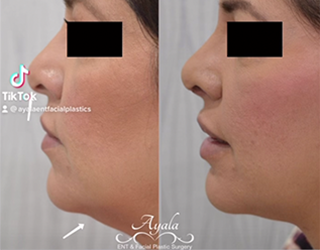 Ayala ENT & Facial Plastic Surgery